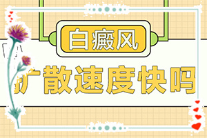 白癩風(fēng)可以治療好嗎？有什么土方法嗎（診療白斑這些是關(guān)鍵）