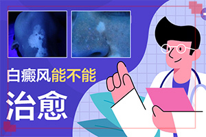 [應(yīng)該如何治療]陰道白班怎么治