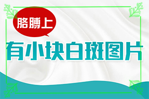 白殿斑早期圖片,一般長在什么部位呢(常見診斷方式)