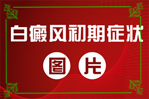 白癜風(fēng)什么因素能導(dǎo)致-打瘦臉針臉部出現(xiàn)白斑怎么回事