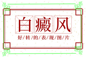 身上長(zhǎng)白班怎么辦,具體表現(xiàn)有哪些(如何診斷)