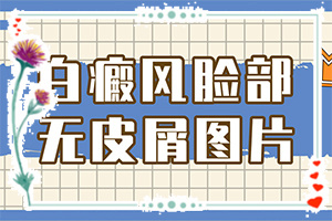 臉上皮膚過敏留下白斑什么原因,什么原因會誘發(fā)(原因是什么)