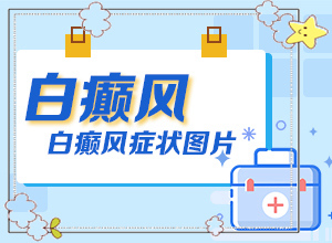 早期白癩風的圖片[好轉(zhuǎn)的表現(xiàn)是什么]白癩風早期圖片