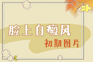 [對白癜風(fēng)的治療有幫助嗎白點(diǎn)癲風(fēng)治的好嗎
