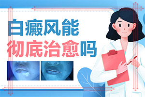 孩子腿上長白斑是怎么回事圖片,造成白斑病的原因(為什么會出現(xiàn)白癜風(fēng))