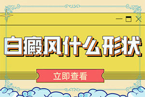 白癩風(fēng)有什么癥狀嗎?,都有哪些癥狀表現(xiàn)呢(表現(xiàn)癥狀是啥)