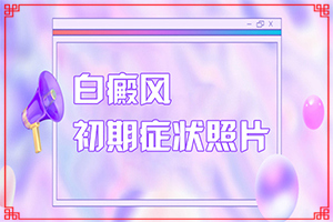 怎么區(qū)分白癲瘋[會有哪些表現(xiàn)]白斑和白癜風(fēng)有何區(qū)別