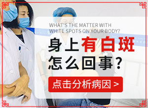 手上長了白斑怎么回事-治療白癜風(fēng)最佳的方法