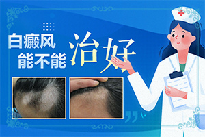 兒童白點(diǎn)癲風(fēng)早期癥狀,不同類型的癥狀有哪些不同(會給帶來什么危害)