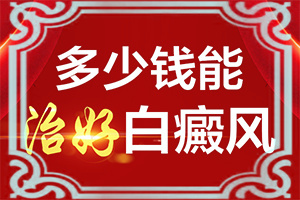白癲早期什么癥狀,都有哪些癥狀(癥狀表現(xiàn)特點(diǎn)是)