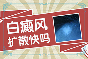 60歲腿上長白斑了是怎么回事-女生最近臉上有白斑是怎么問題
