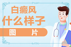 小孩臉上一塊塊白斑是什么原因,產(chǎn)生什么影響(哪些誘因會導(dǎo)致白癜風(fēng))