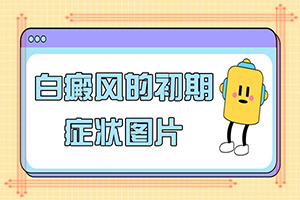 腳小腿長白斑是什么原因[都有哪些表現]白癲風早期圖片