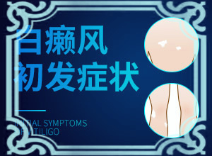 孩子夏天臉上有白斑是什么原因,發(fā)病的原因有哪些(什么原因會(huì)誘導(dǎo)白斑)