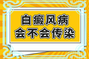 白癲的治療有效醫(yī)院[治療方法有哪些]治療兒童癲方法