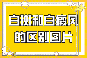 白的治療方法是什么,真的能盡快治療好嗎(大了點(diǎn)怎么辦)