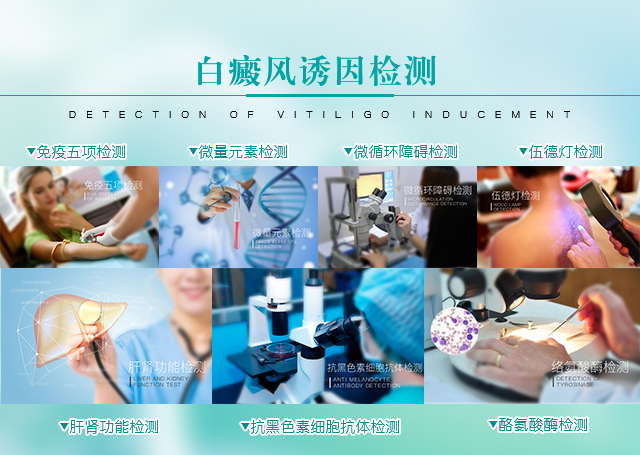 白癜風檢查