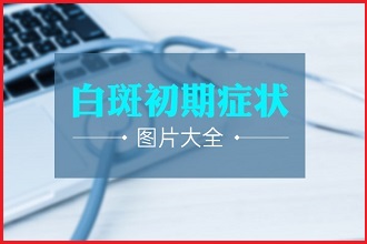白點(diǎn)風(fēng)患者如何進(jìn)行科學(xué)有效的醫(yī)治