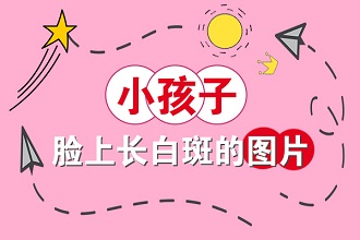 白癩風(fēng)患者可以使用遮蓋液嗎?遠離不利因素才是重點