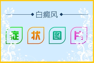 甕安縣白點(diǎn)風(fēng)患者頸部患病注意哪些!