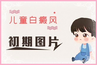 青少年白癩風(fēng)頻發(fā)，這些原因你都了解嗎