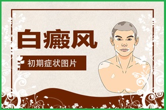 白癩風(fēng)遮蓋液去哪家買(mǎi)好，什么牌子的比較好用呢