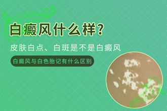 頸部白癩風發(fā)作的因素，原來是生活中容易忽視的細節(jié)