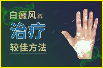 白顛風(fēng)怎么治療好的快-檢查病因、制定方法、防護(hù)三步走