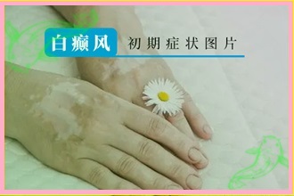 白白課堂|孕婦白點(diǎn)癲風(fēng)是什么原因引起的-科學(xué)檢測(cè)便利病情醫(yī)治