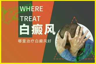 白癲風(fēng)的早期癥狀圖片避免擴(kuò)散，這些措施要一一執(zhí)行