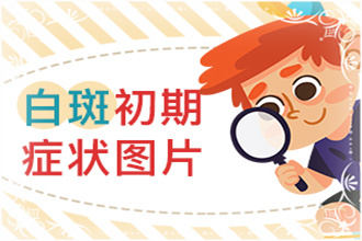 白點風(fēng)能嗎-病情反復(fù)發(fā)作-科學(xué)醫(yī)治才是正途