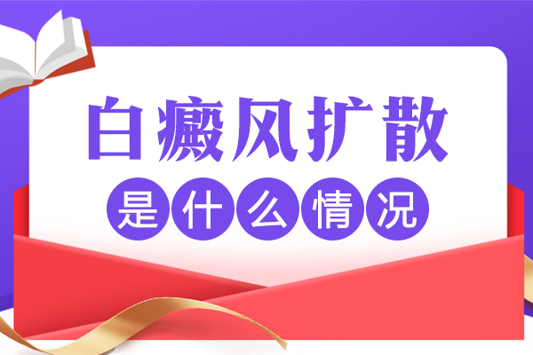 白癜風(fēng)擴(kuò)散期間,患處會(huì)瘙癢嗎？白斑擴(kuò)散的癥狀是什么？
