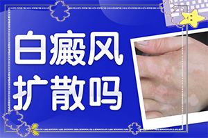 小孩子臉上有小白斑用什么藥可以治療（怎么治療比較好）