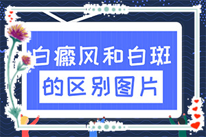 手背有白色斑點是怎么回事(發(fā)病的原因有哪些)