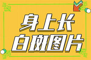 十歲兒童臉上有白斑是怎么回事,因為什么患上(因素有哪些呢)