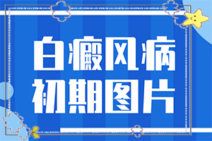 白癩風(fēng)輕度的圖片[區(qū)別在哪呢]皮膚出現(xiàn)白班是否白斑