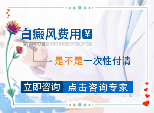 有沒有什么藥膏治療白癜風(fēng)好,應(yīng)該做些(方法是什么)