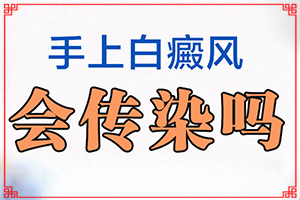 白點癲風的癥狀,看起來都是啥樣子的(全面檢查哪些癥狀)