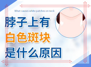 臉上白斑是什么原因，如何解決,什么原因會誘導白斑(常見原因)