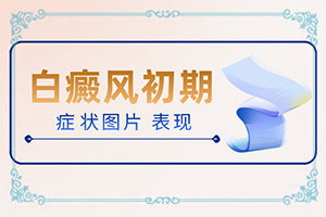 白點(diǎn)癲風(fēng)治療費(fèi)用[怎樣治療白癜風(fēng)患者]小孩臉上有白斑怎么治療