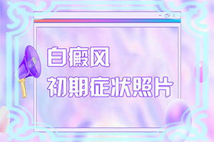 白顛瘋病可以治愈嗎?[治療需要注意什么]小孩白點(diǎn)癲風(fēng)怎么治療