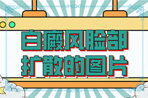 白顛風(fēng)能治好嗎[治療方法有哪些]小孩得了白癲風(fēng)能治好嗎