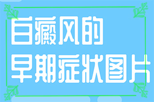 白點癲風(fēng)的圖片早期[如何診斷正確的呢]胳膊起白班怎么回事