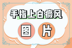 白癩風(fēng)圖片早期圖片,常見癥狀有什么特點(diǎn)(有什么區(qū)別呢)