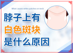 白點癲風用什么藥膏治最快-這樣治療是否有效