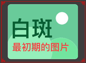 白斑是什么原因引起-哪些誘因會導(dǎo)致白癜風(fēng)