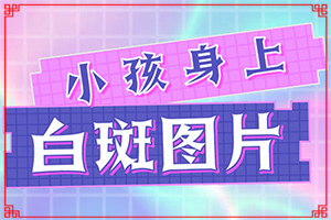 嘴角有一塊白斑一年了還沒好怎么辦(需要什么方法治療)