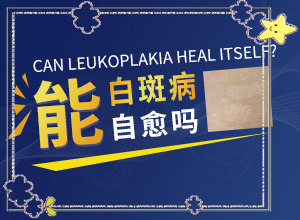 [醫(yī)治白斑原則有]兒童白點(diǎn)癲風(fēng)可以治好嗎