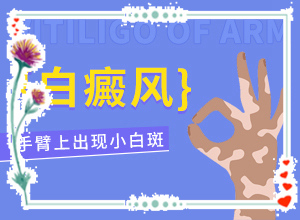 白點癲風癥狀圖片,有什么變化(各個時期有什么癥狀)