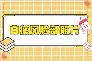小寶寶脖子上有白斑點(diǎn)是什么原因，怎么治療（為何不易治）